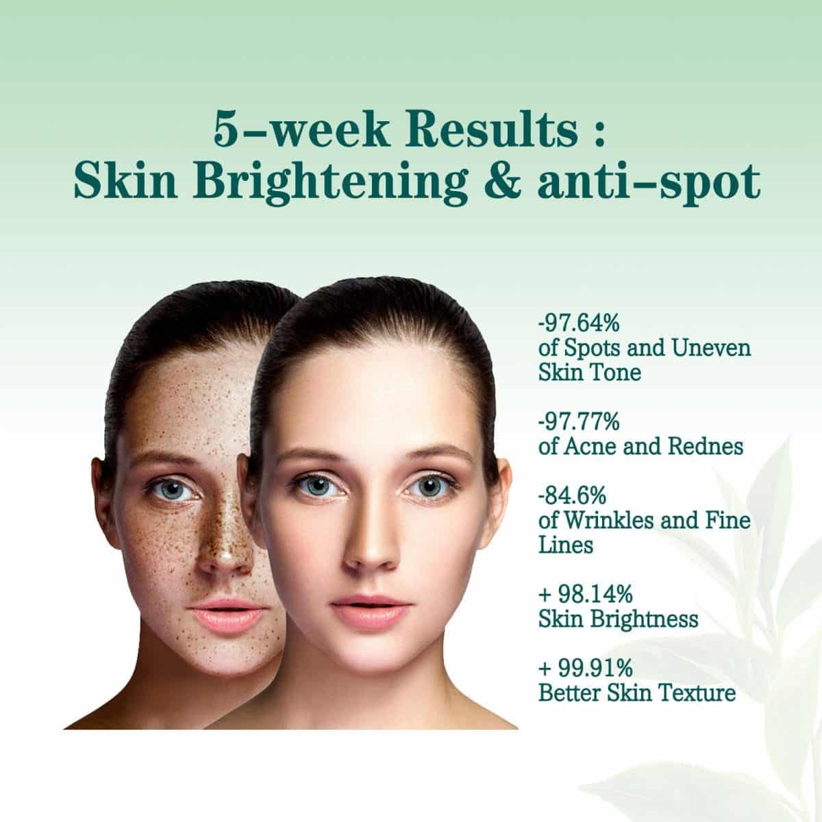 Anti Melasma Blemish Moisturizing And Brightening Skin Essence