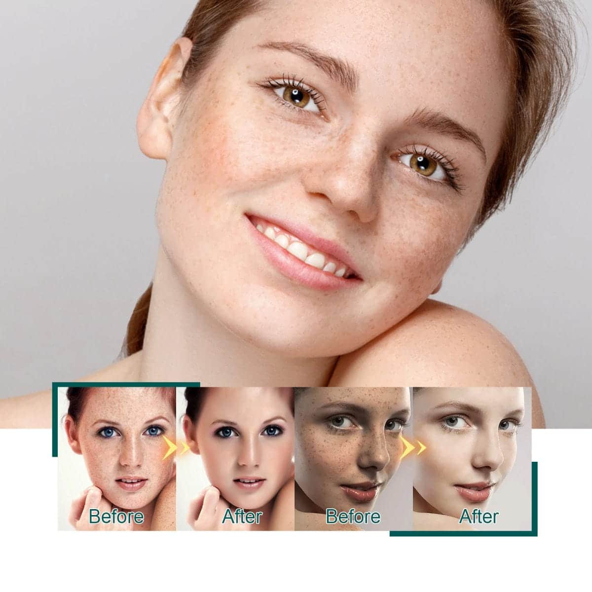 Anti Melasma Blemish Moisturizing And Brightening Skin Essence